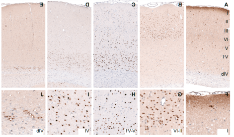 大鼠大脑皮层蛋白质表达的层状分布.png