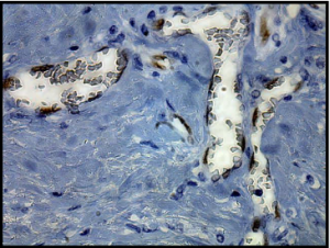 人乳腺肿瘤用兔单克隆抗人/小鼠ID1