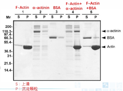 Actin结合蛋白分析试剂盒.jpg