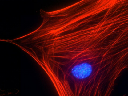 Swiss 3T3 细胞肌动蛋白应激纤维染色.png